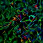 image: Image from the photoset ‘
glow (iii)
’.