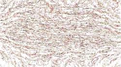 Eighth of 'reflets — paint synthesiser classic — 3.0 collection frothy 5'.