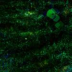 image: Image from the photoset ‘
damage (cccix)
’.