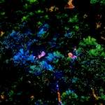 image: Image from the photoset ‘
damage (ccli)
’.