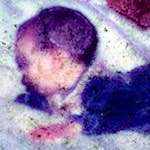 image: Image from the photoset ‘
damage (xvi)
’.