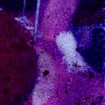 image: Image from the photoset ‘
damage (v)
’.