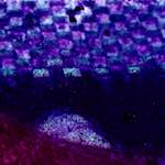 image: Image from the photoset ‘
damage (v)
’.