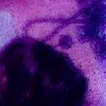 image: Image from the photoset ‘
damage (v)
’.