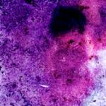 image: Image from the photoset ‘
damage (v)
’.