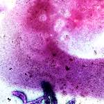 image: Image from the photoset ‘
damage (vi)
’.