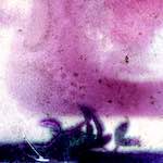 image: Image from the photoset ‘
damage (vi)
’.