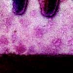 image: Image from the photoset ‘
damage (vii)
’.