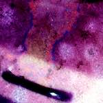 image: Image from the photoset ‘
damage (vii)
’.