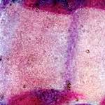 image: Image from the photoset ‘
damage (xiv)
’.