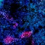 image: Image from the photoset ‘
damage (xlv)
’.