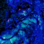 image: Image from the photoset ‘
damage (xlvii)
’.