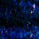 image: Image from the photoset ‘
damage (liii)
’.