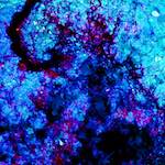 image: Image from the photoset ‘
damage (liv)
’.