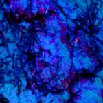 image: Image from the photoset ‘
damage (lxi)
’.