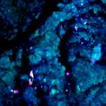 image: Image from the photoset ‘
damage (lxxix)
’.