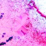 image: Image from the photoset ‘
damage (lxxxviii)
’.