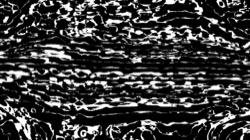 black n white :: srcprocbwskel2