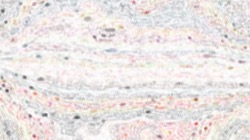 image: image from chalk